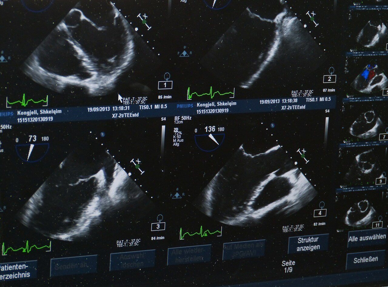 awasome-how-much-does-an-ultrasound-technician-make-in-texas-references