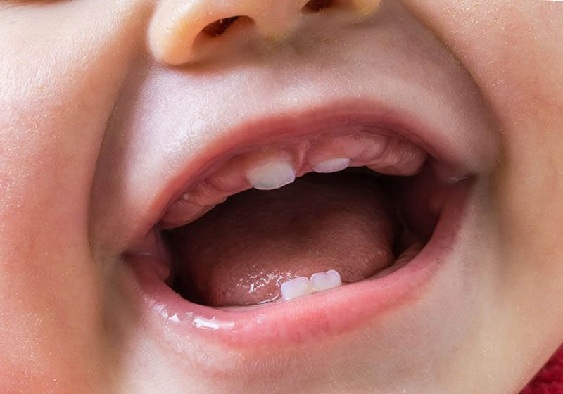 When Do Baby Teeth Come In? All You Ever Wanted To Know — Caring
