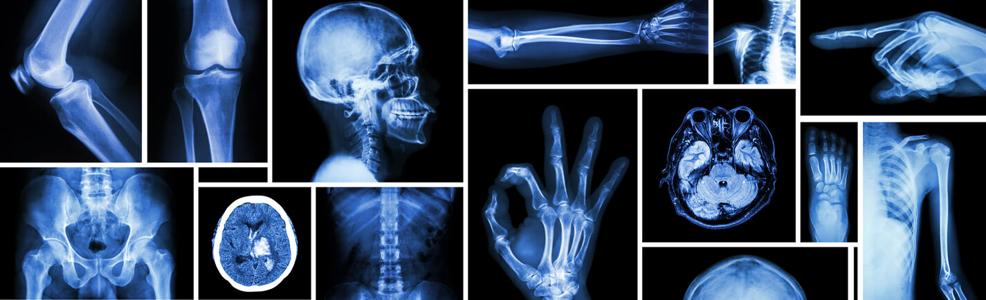XRay Carlsbad Imaging Center Imperial Radiology