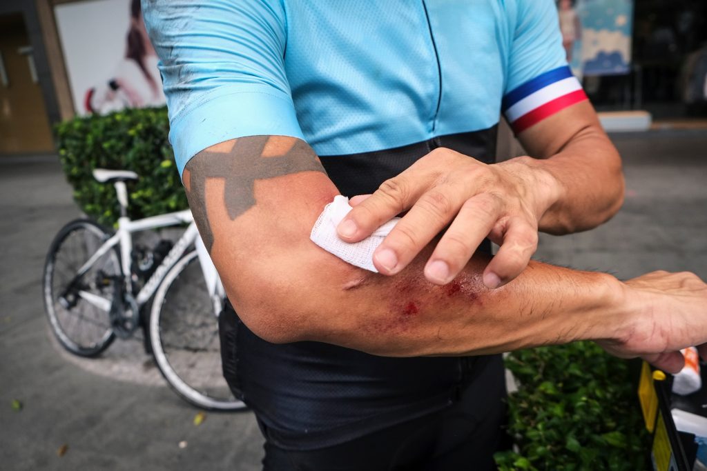 Why Road Rash Should Be Taken Seriously Carmody and Ging