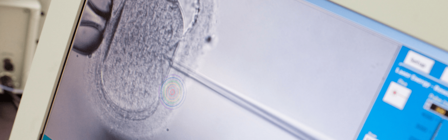 Progesterone Levels Prior to Embryo Transfer Carolina Conceptions