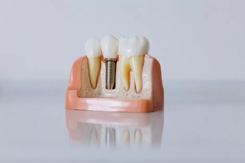 7 Dental Implant Maintenance Errors and How to Avoid Them