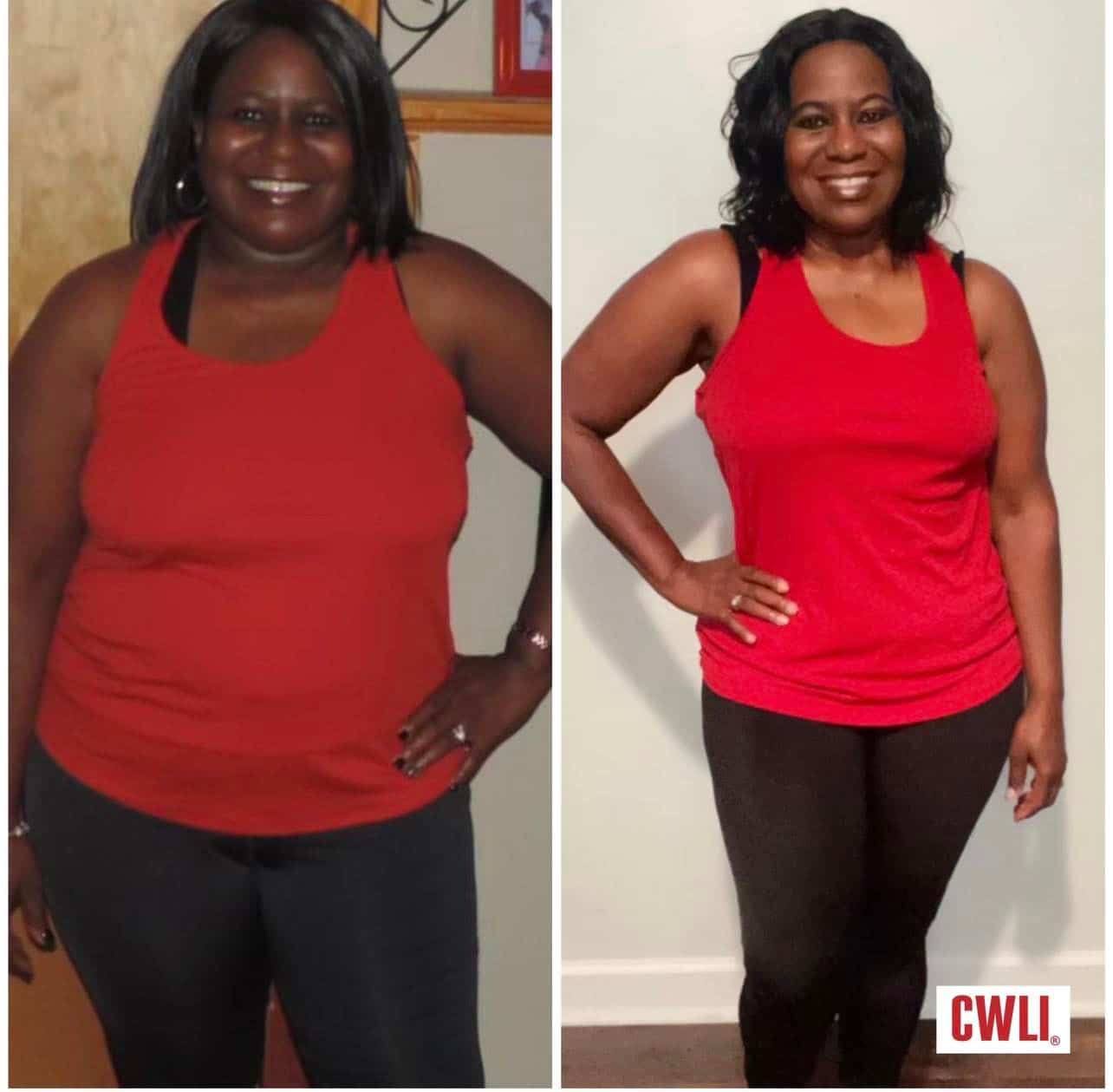 CWLI's Very Own Barbara Shares Her 73 Pound Weight Loss Journey Carolinas Weight Loss Institute