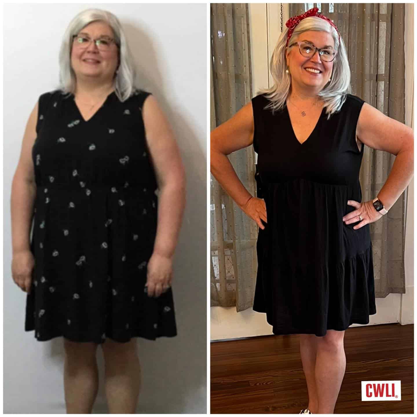 Kelly Loses An Additional 6 Pounds On Her MAINTENANCE Plan Carolinas Weight Loss Institute