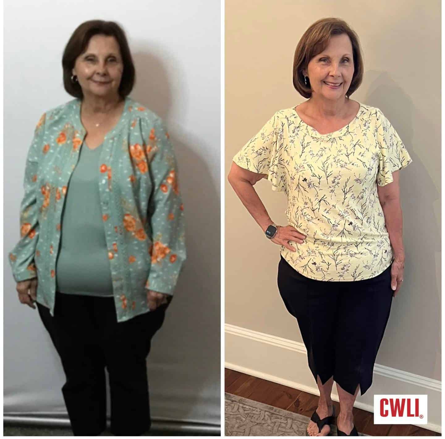 Mary Loses 22 Pounds In 9 Weeks At Carolinas Weight Loss Institute Carolinas Weight Loss Institute