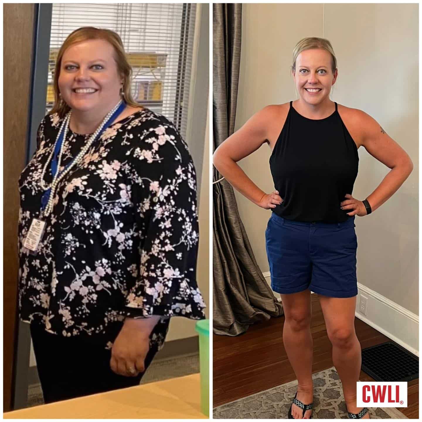 See Penny’s Amazing Transformation 75 Pounds Lost! Carolinas Weight Loss Institute