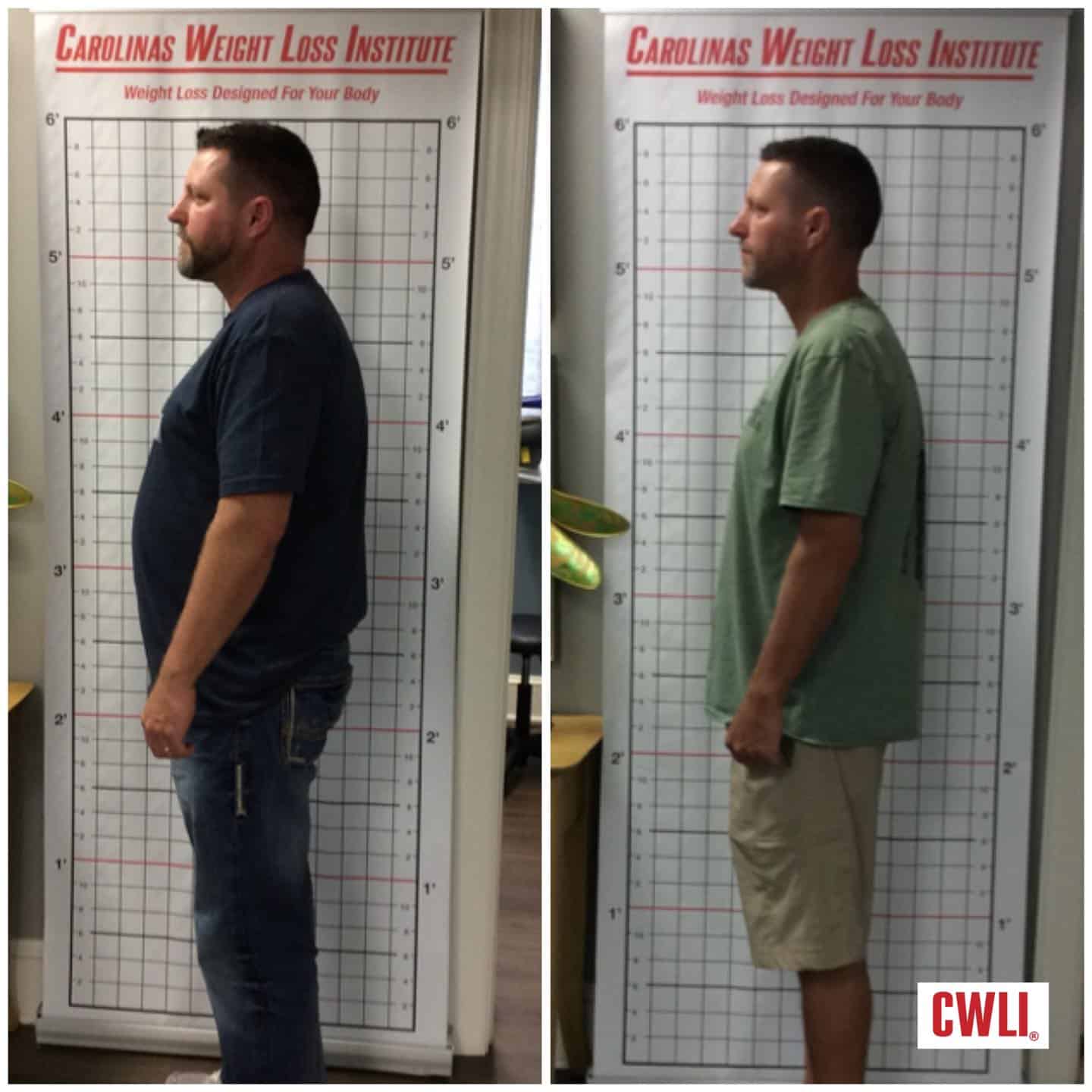 Ryan Loses 47 Pounds In 40 Days With Carolinas Weight Loss Institute Carolinas Weight Loss