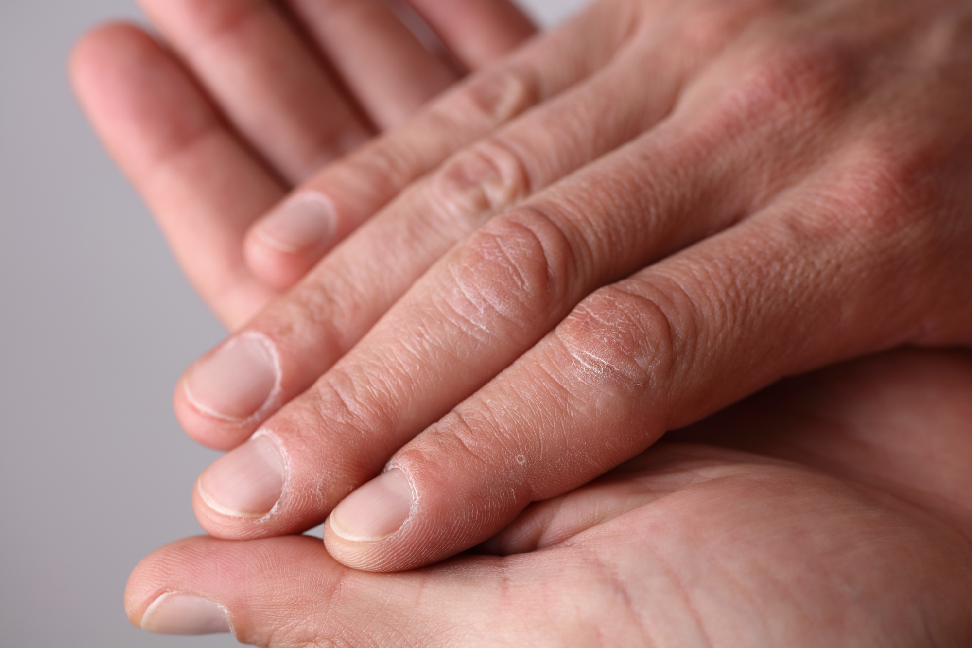 9 Causes of Tingling Hands