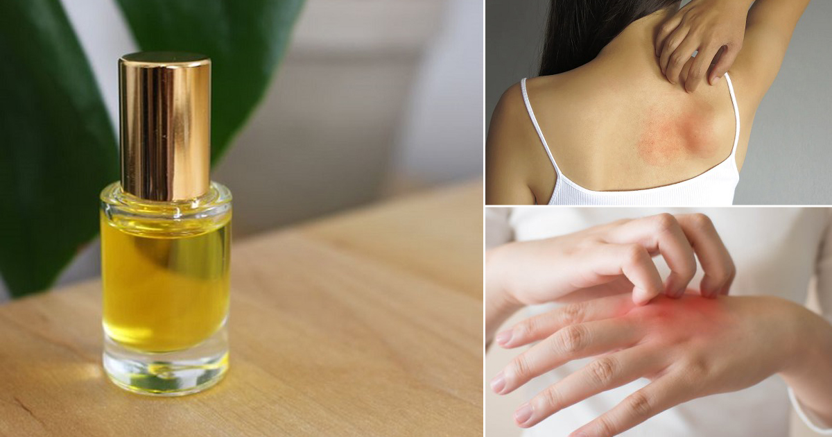 Is Castor Oil Good For Rashes? Castor Oil Guide