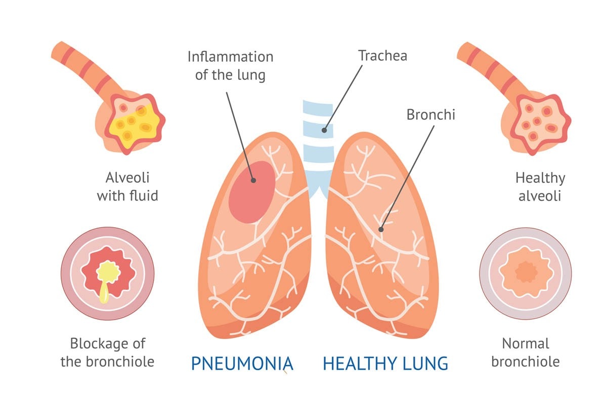 Pneumonia in Cats Causes, Symptoms and Treatment CatWorld