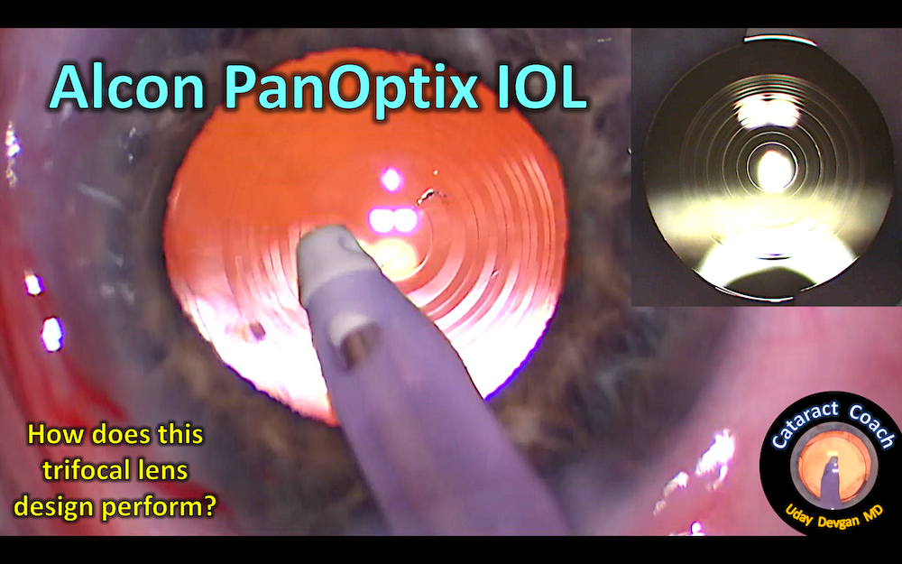 Alcon PanOptix Trifocal IOL Performance Cataract Coach