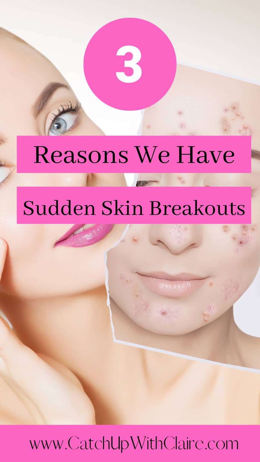 Sudden Spot Breakouts Why Do I Randomly Get Spots?