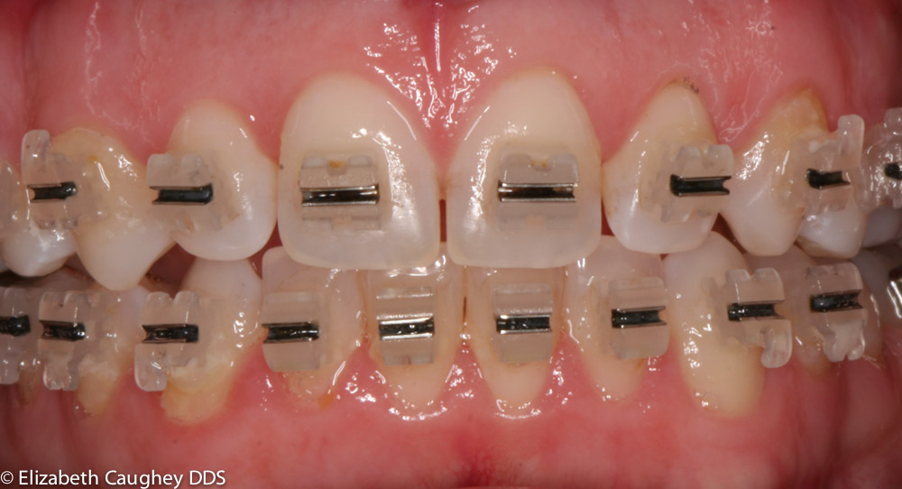 Holistic TMJ, Migraine Treatment Elizabeth Caughey DDSElizabeth