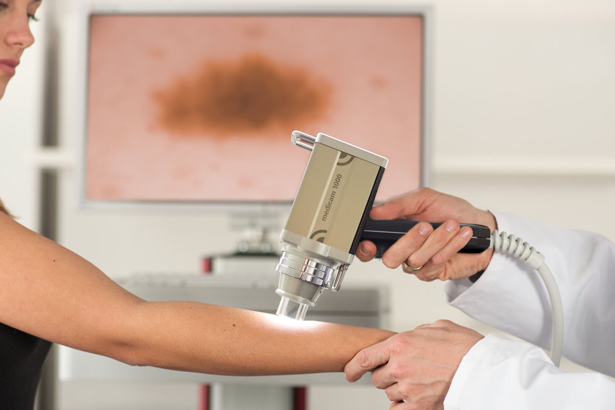 Mole Mapping Cayman Doctors