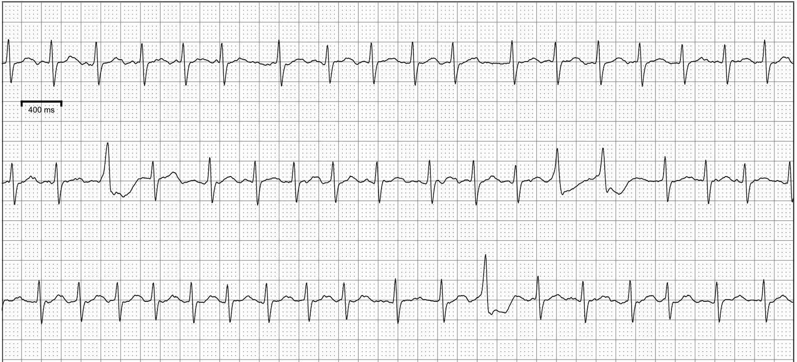Zio Patch Labeling Guide
