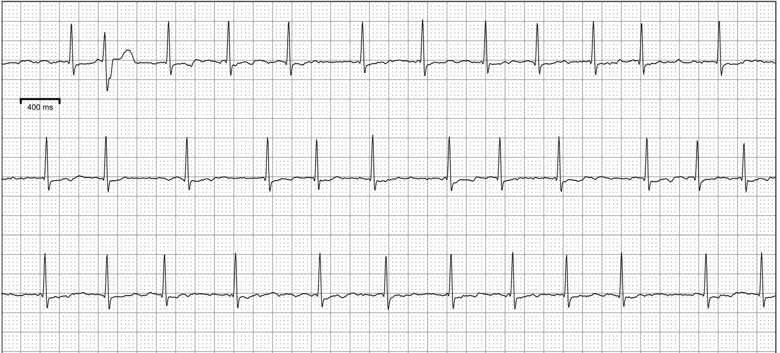 Zio Patch Labeling Guide