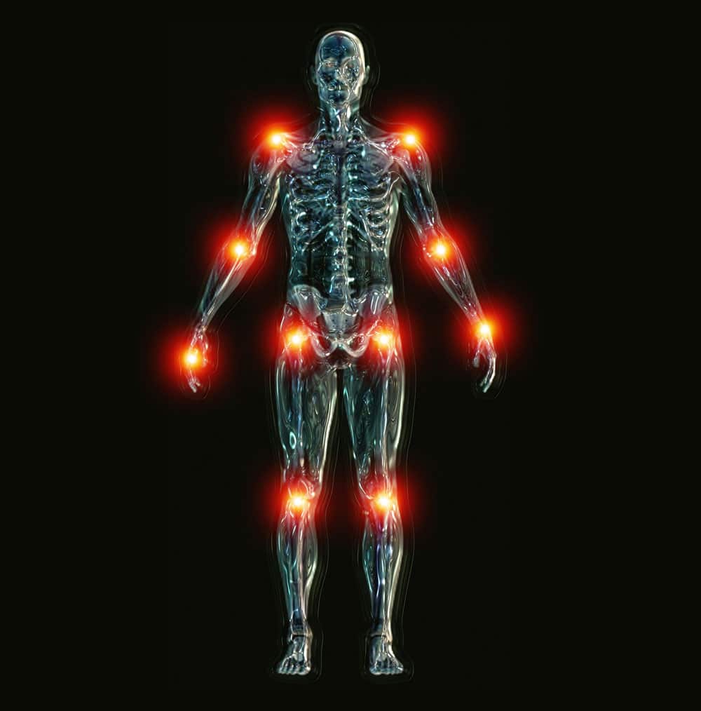 Arthritis 101 Joints Move PainFree with Physical Therapy
