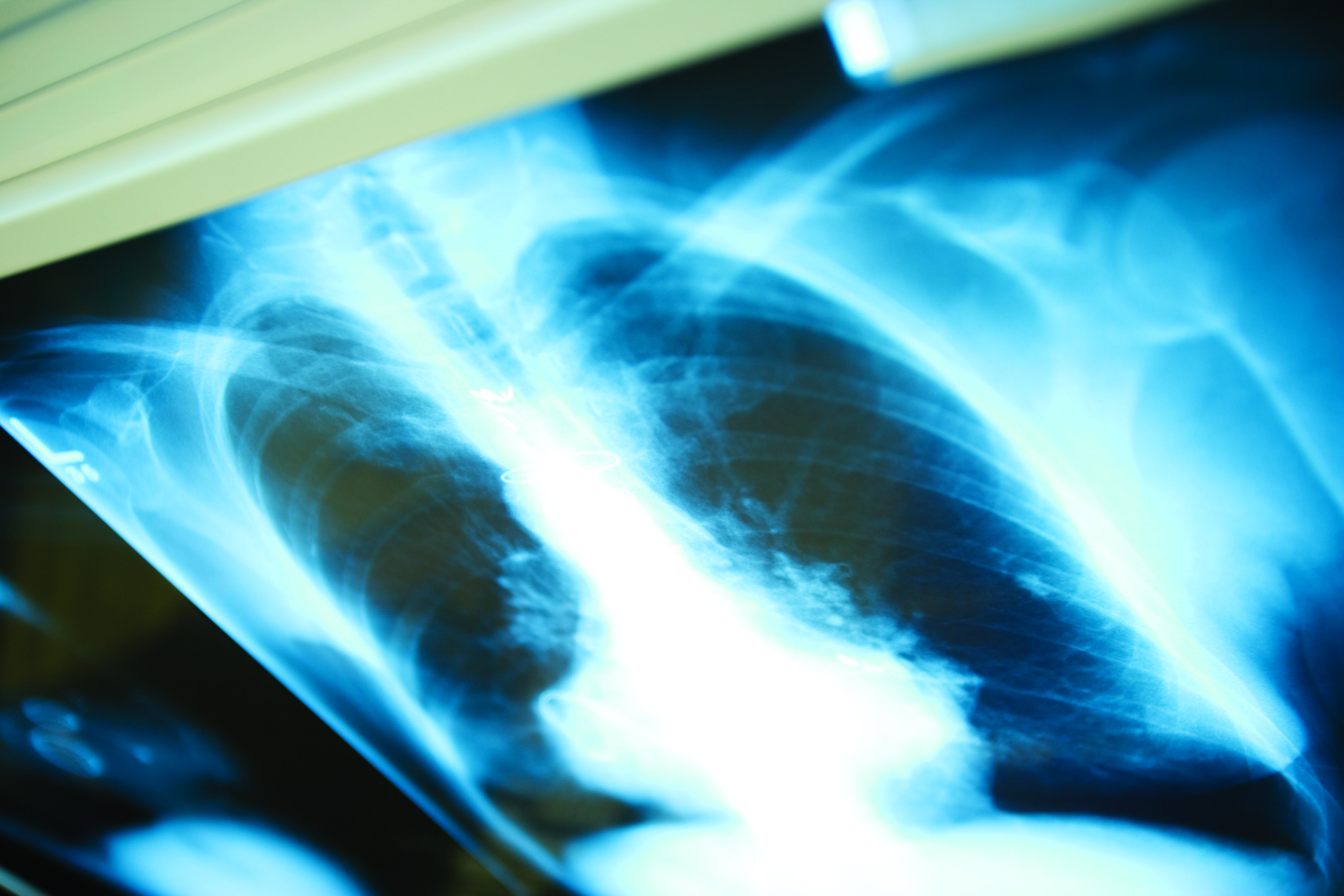 Pulmonology Division to Treat Lung Disease and Sleep Disorders