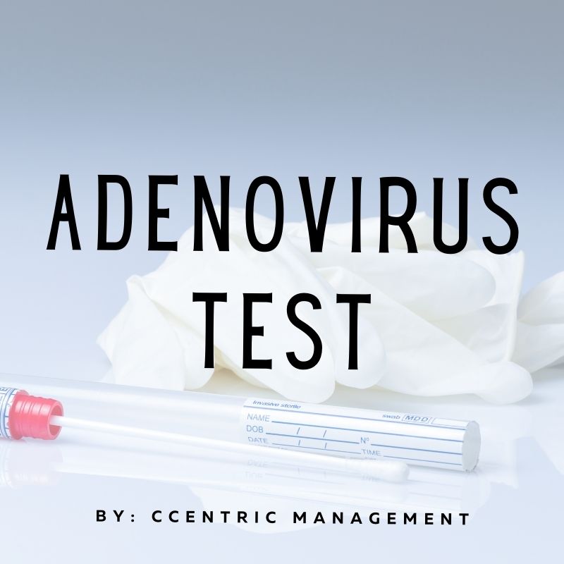 Adenovirus Ag Rapid Test C Centric Management