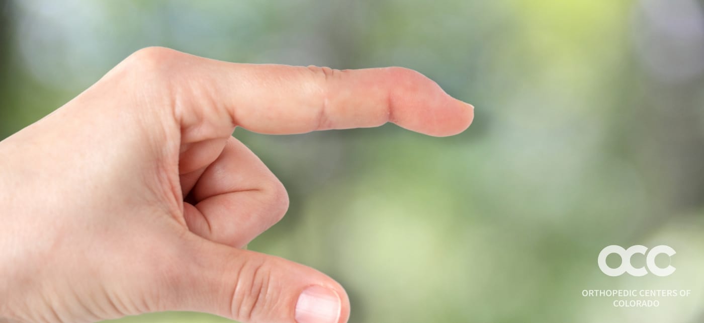 Mallet Finger Colorado Center of Orthopaedic Excellence