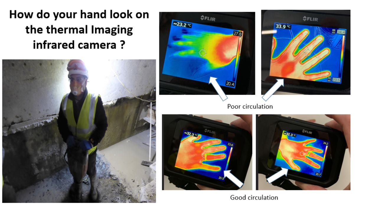 » Thermal Imaging Infrared Camera to Monitor Circulation for HAVS Best