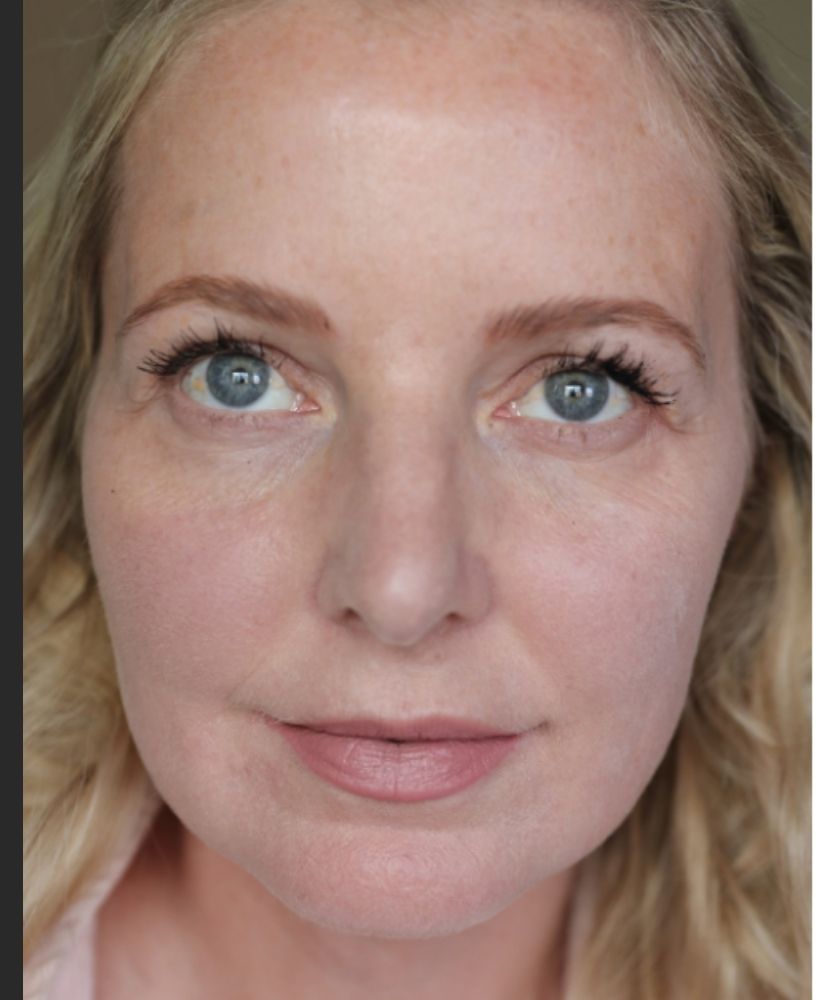 LED Light Therapy Red Light Therapy Led Advanced & Skin Treatment