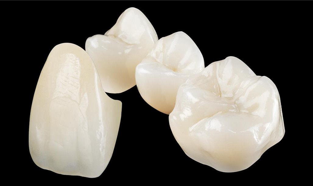 Zirconia Crown vs Emax Crown Which is The Best Option?