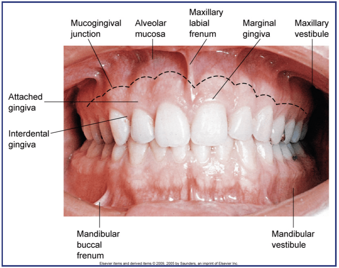 Labial Mucosa Anatomy