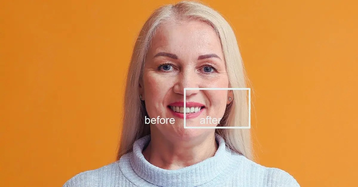 How to Get a Free Dental Makeover 2024