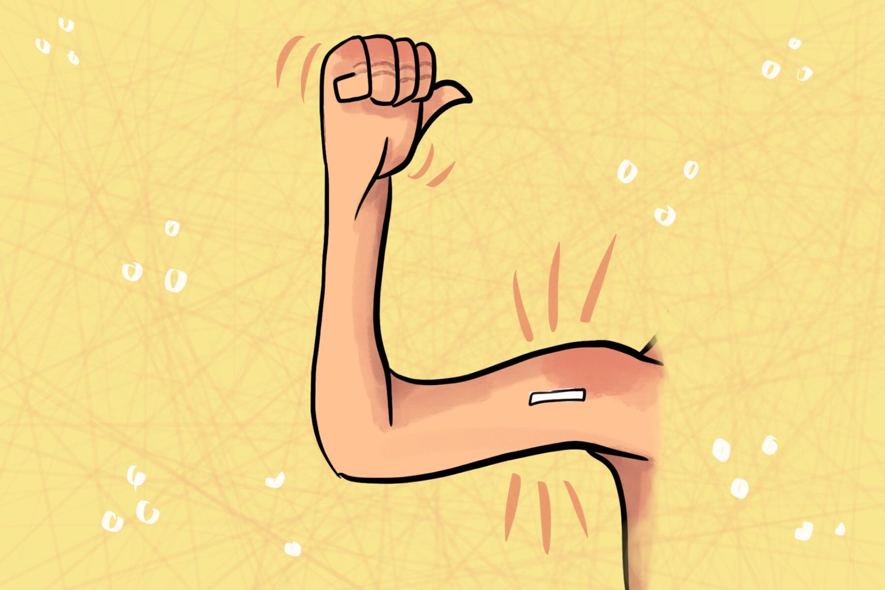 What You Need to Know Before Getting the Nexplanon Implant