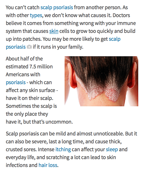 Itchy Scalp Thinning Hair Sale, 60% Off | Www.simbolics.cat