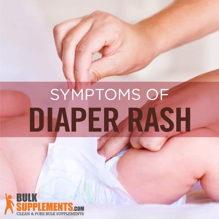Diaper Rash Characteristics, Causes & Treatment
