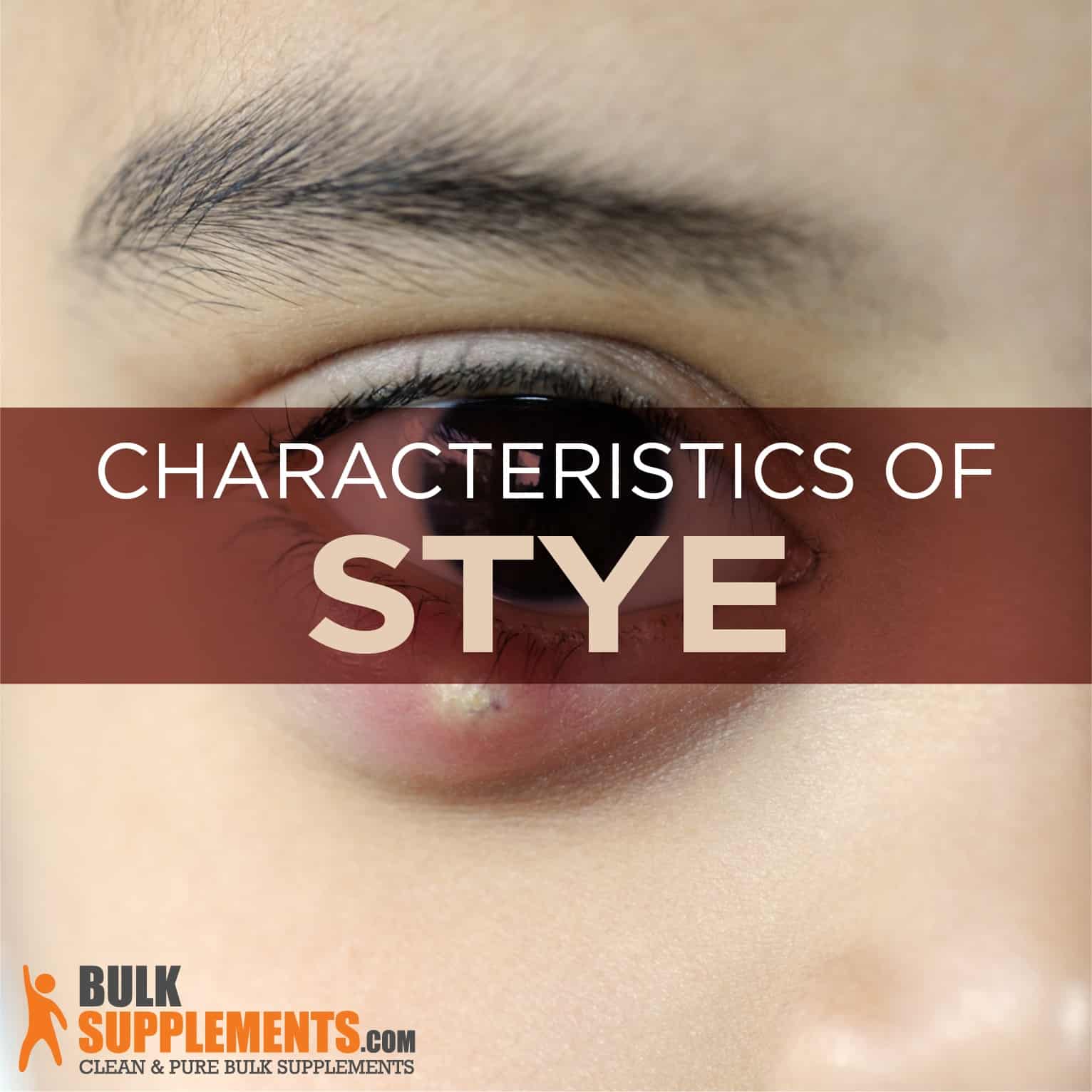Stye Characteristics, Causes & Treatment