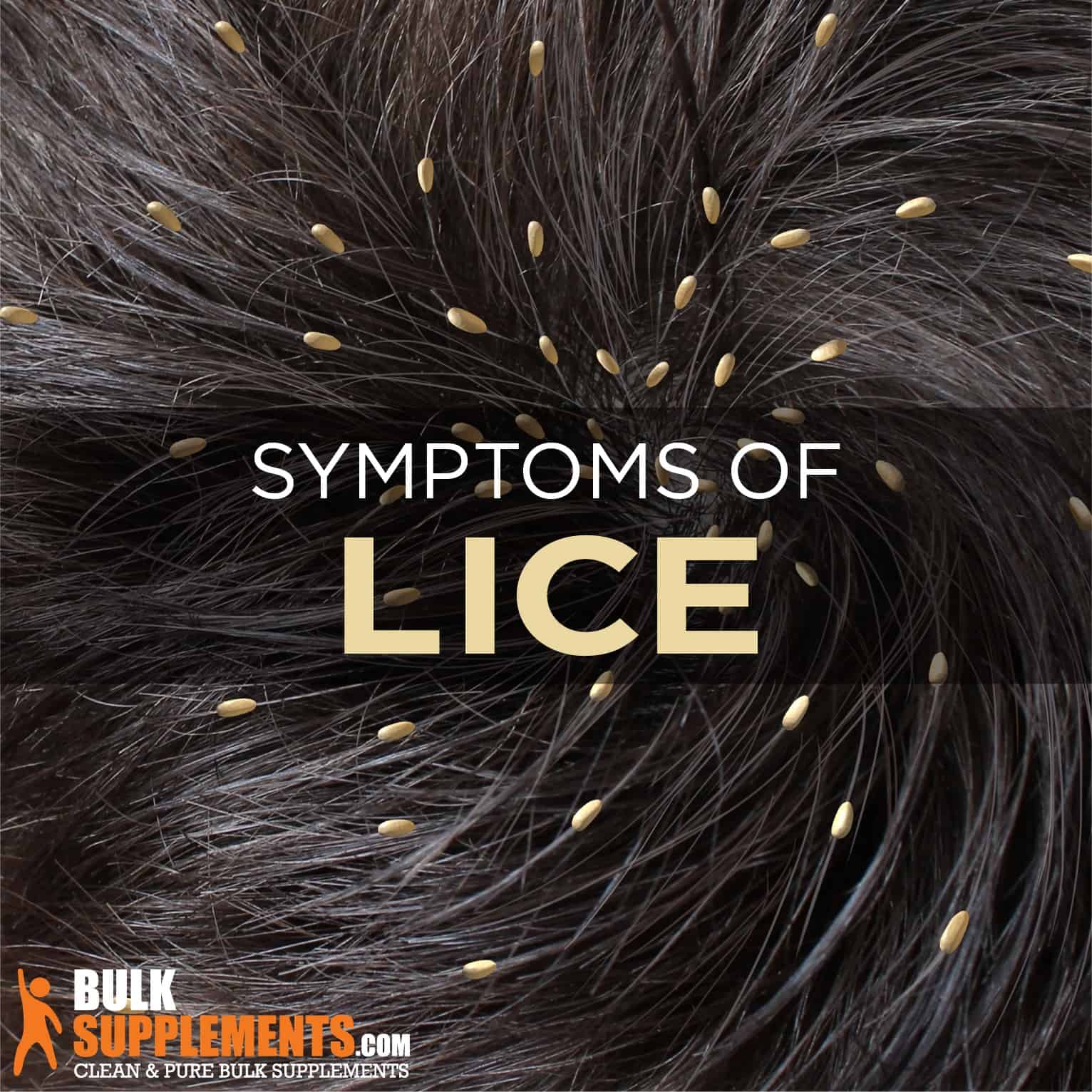 Lice Symptoms, Causes & Treatment by James Denlinger