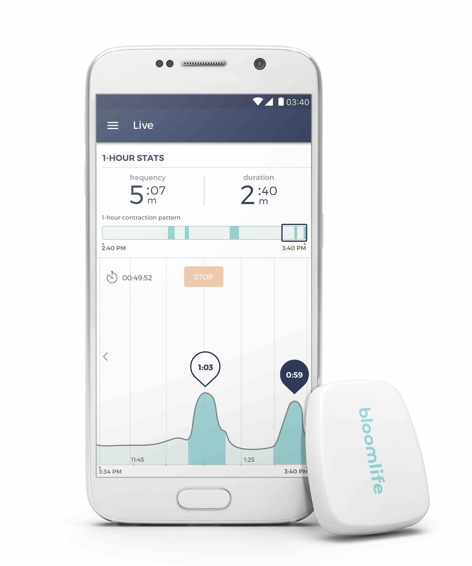 Introducing the Bloomlife smart pregnancy tracker Bloomlife News