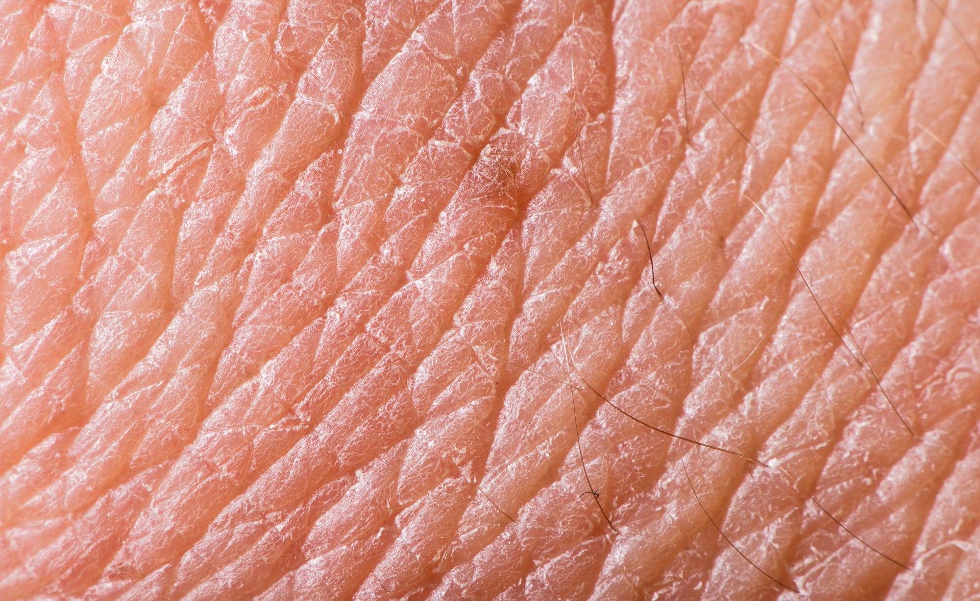 Do Scabies Get In Carpet Carpet Vidalondon