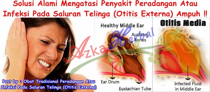 Obat Tradisional Peradangan Atau Infeksi Pada Saluran Telinga