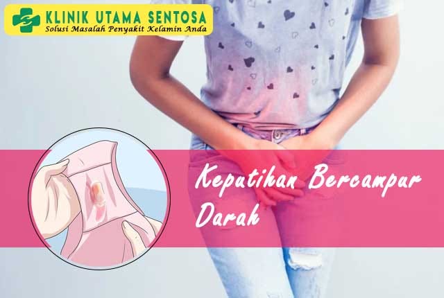 Keputihan Bercampur Darah / Keputihan Bercampur Darah Awas Bisa