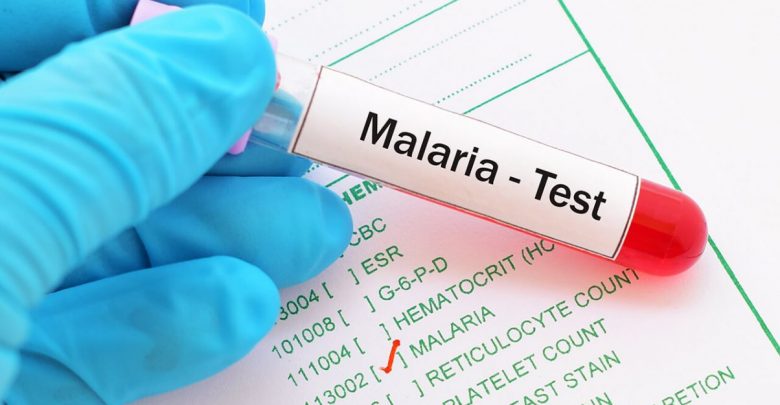 Highly Sensitive Rapid Diagnostic Testing Kits to