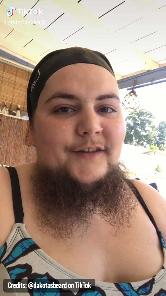 TikTok Woman Decided to Embrace her Facial Hair and Decided to Grow a Beard