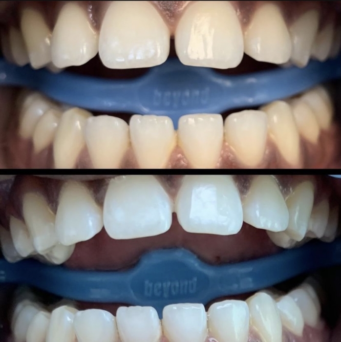 Schedule Appointment with CherishYourSmile