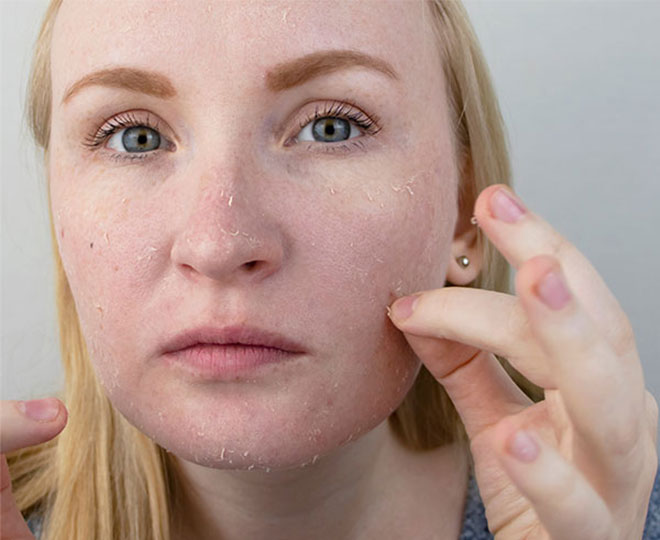 How to get rid of dead skin cells on your face Proactiv®