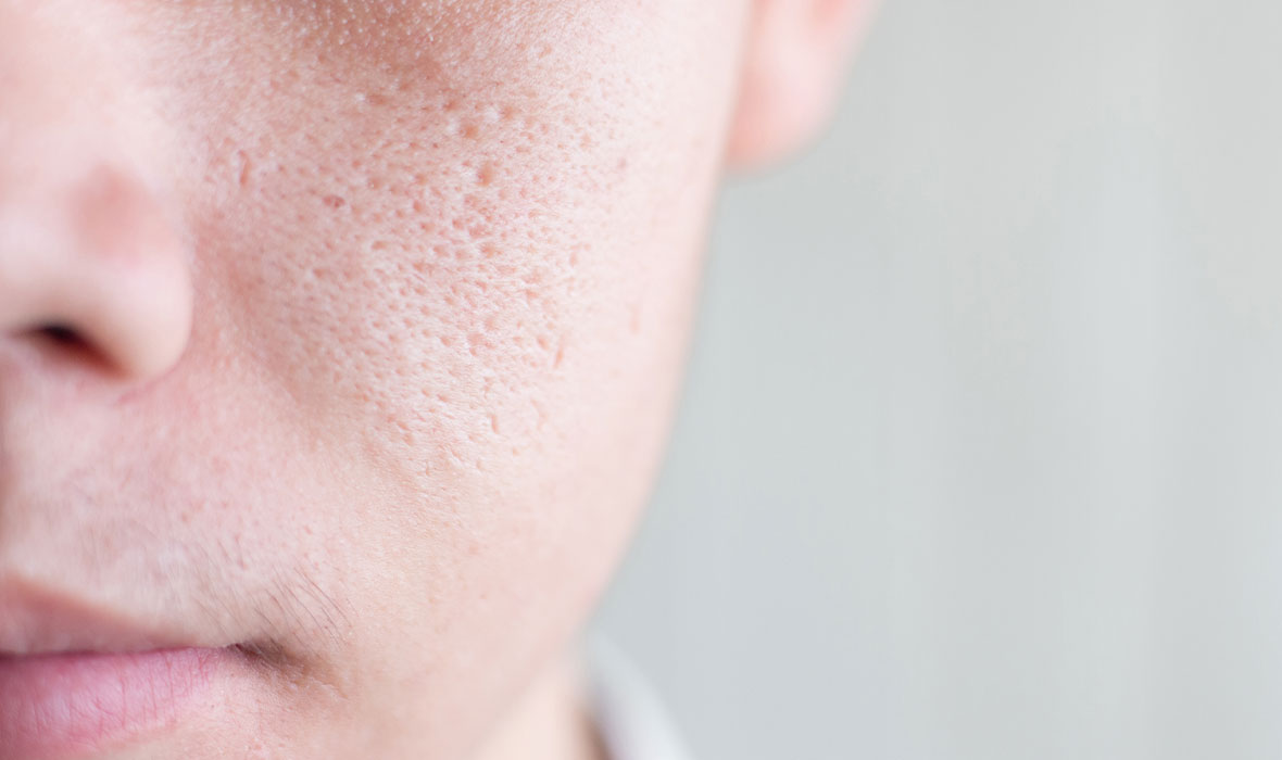 How to improve skin texture and get smooth skin Proactiv®