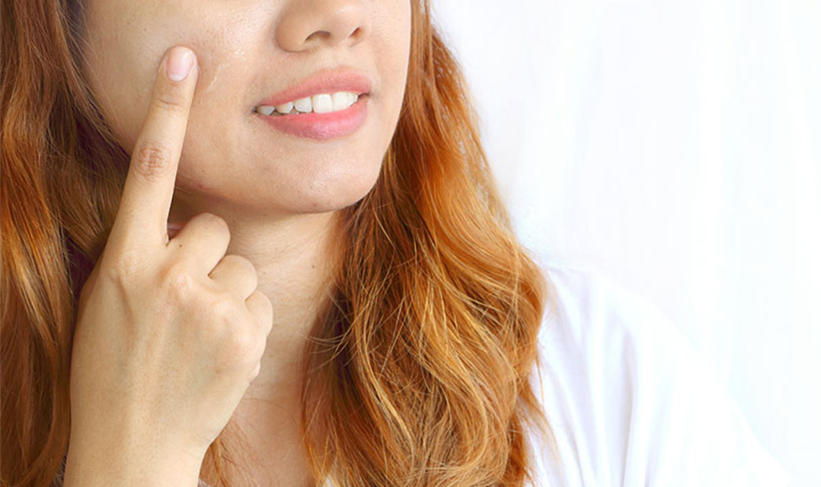 3 Things You May Not Know About Pores on Your Face Proactiv®