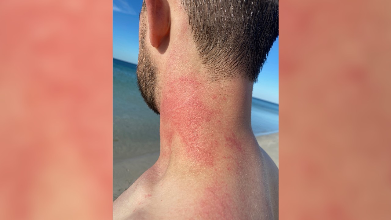 Angry octopus attacks man who filmed it at popular snorkeling spot in