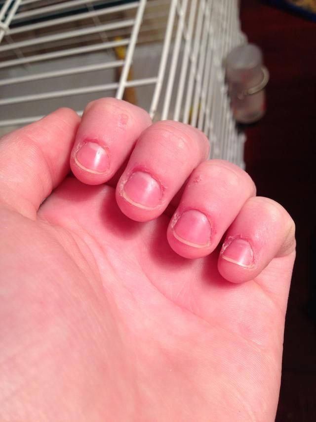 Caring For Your Cuticles What Happens When They Come Off And How To