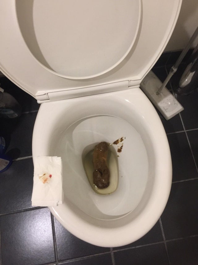 Can I Flush Dog Poo Down The Toilet
