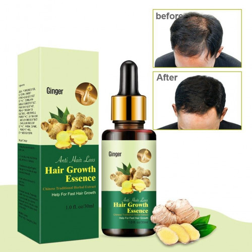 Ginger Hair Growth Essence Oil Price in Bangladesh Bdstall