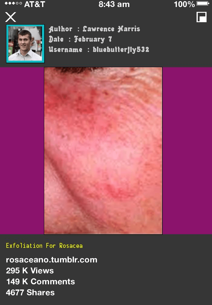 The Benefits Of Exfoliating For Rosacea Sufferers Beckley Boutique