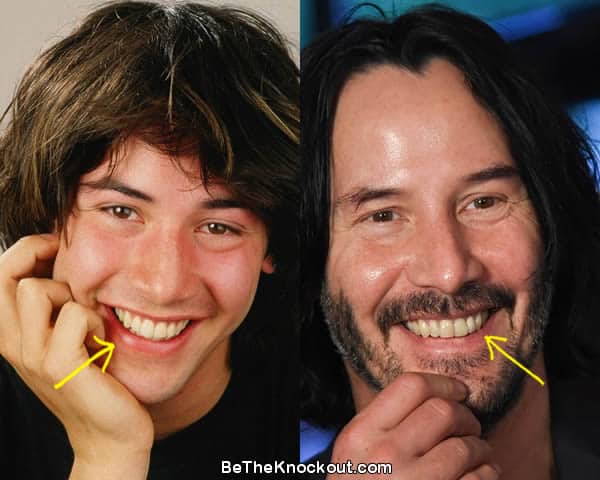 Keanu Reeves Plastic Surgery Comparison Photos